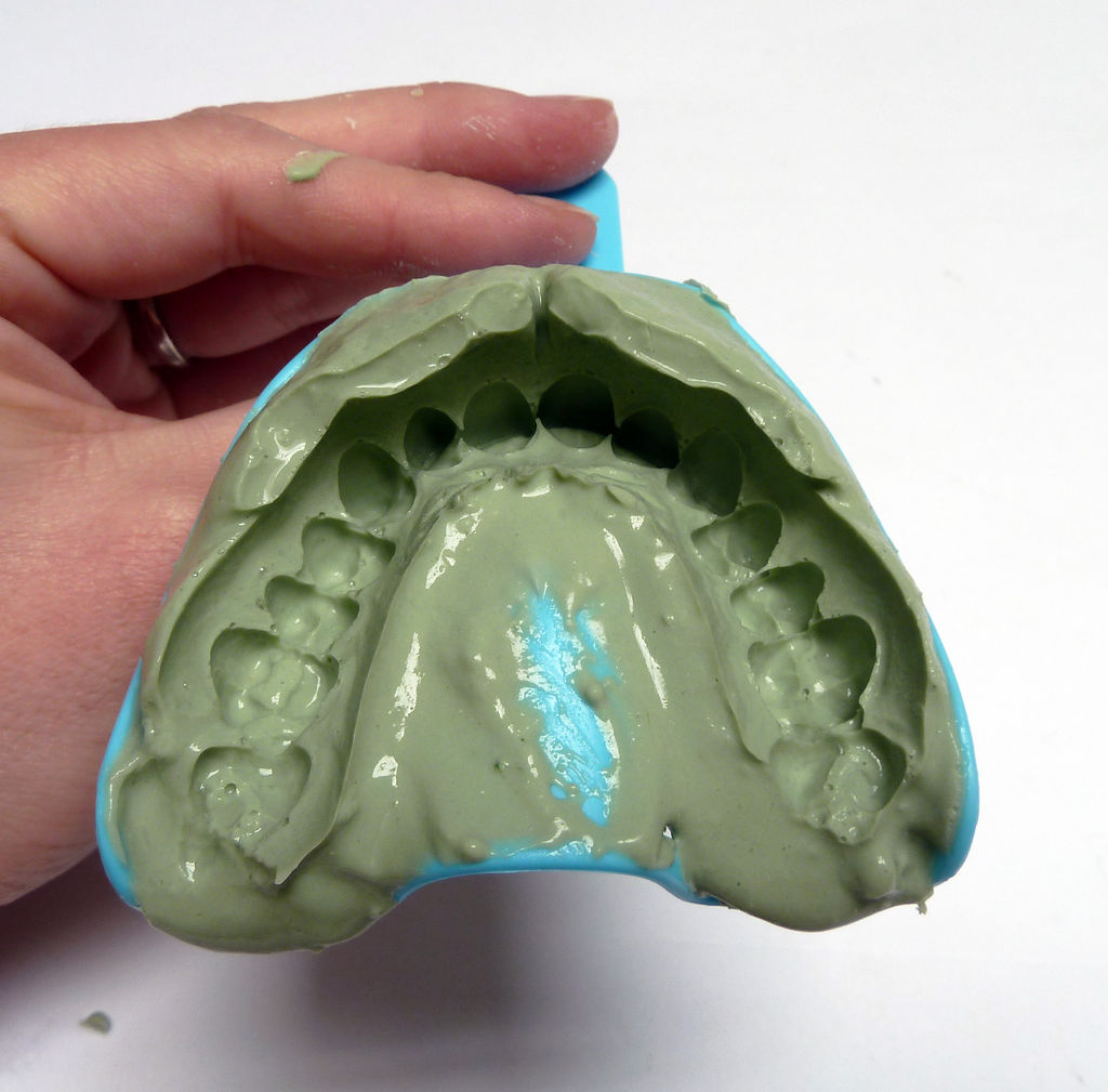 تجهیزات دندان پزشکی قالب