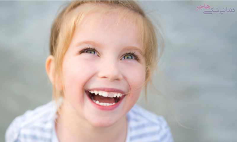 تغییر رنگ و سیاه شدن دندان در کودکان
