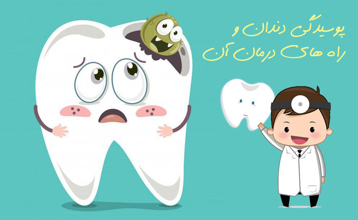 پوسیدگی دندان و راه های درمان آن