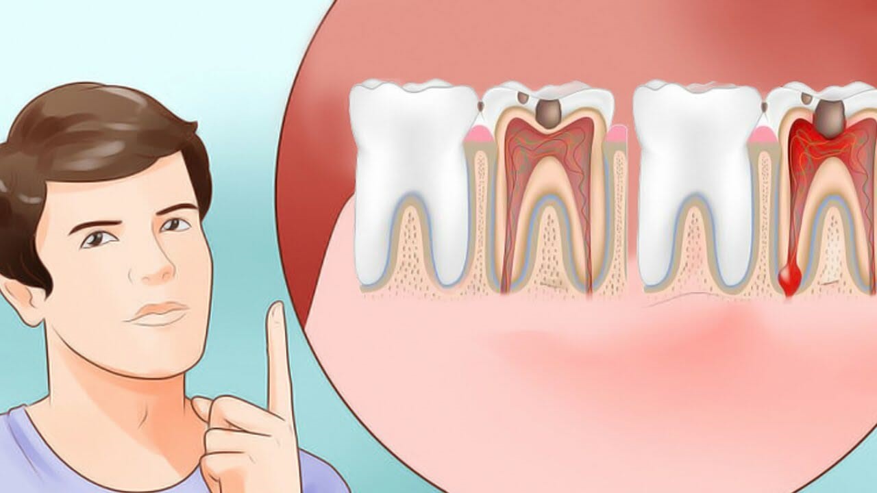 دندان درد2