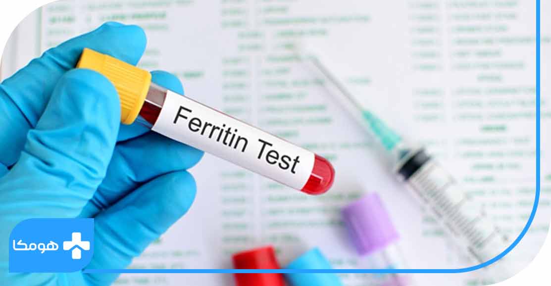 میزان نرمال Ferritin در زنان